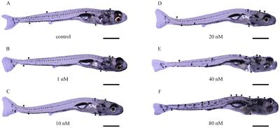 Thyroid hormone regulates both melanin and non-melanin pigmentation in Sinibrama taeniatus via three types of chromophores